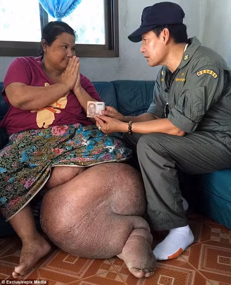 Nguoi phu nu chan voi da duoc dieu tri nho long hao tam cua nguoi la - Anh 2