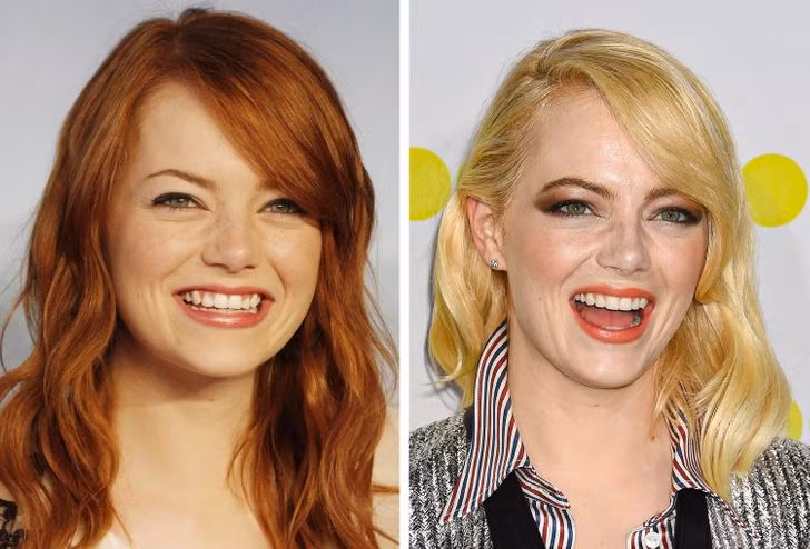 Emma Stone