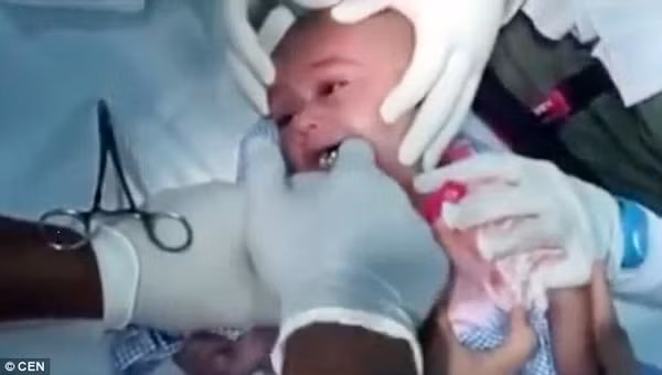 Nghẹt thở cảnh giải cứu bé trai 1 tuổi nuốt phải đồng hồ đeo tay