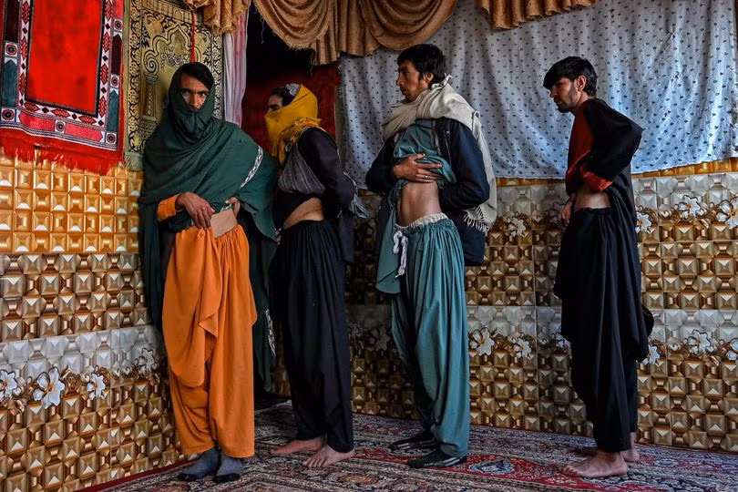 Nhiều người ở Shenshayba Bazaar - một ngôi làng của Afghanistan đã quyết định bán một quả thận của mình để trả nợ và mua thức ăn.