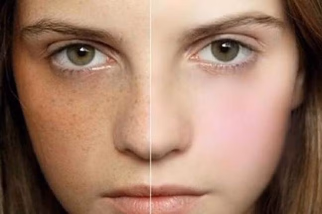 Tạm biệt da nhăn nheo, thâm nám chỉ với mặt nạ TRÁI BƠ