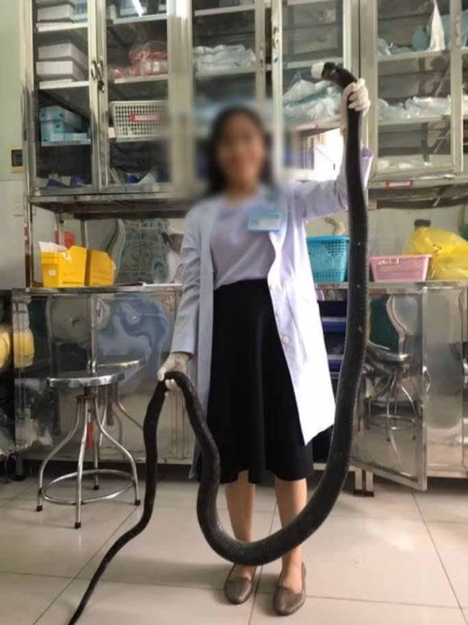 CLIP: Tài xế kể chuyện chở người bị rắn hổ mang chúa cắn ở núi Bà Đen đi cấp cứu - Ảnh 3.