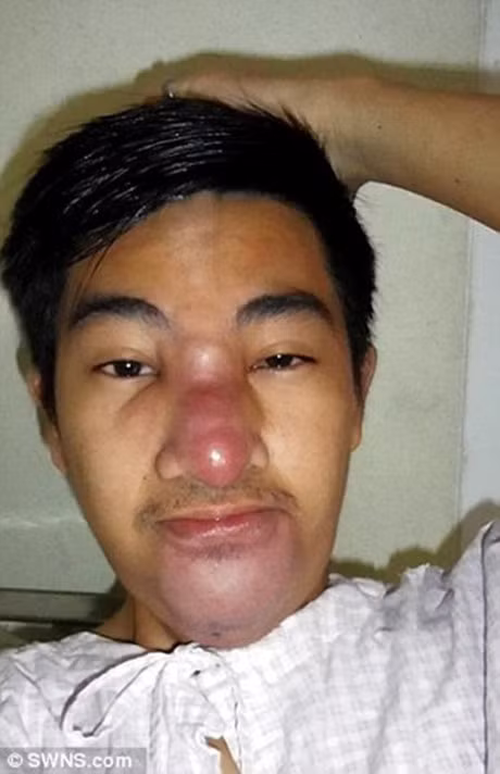 Nang mui voi gia 250 ngan dong, chang trai phai chiu bien chung kinh hoang - Anh 3