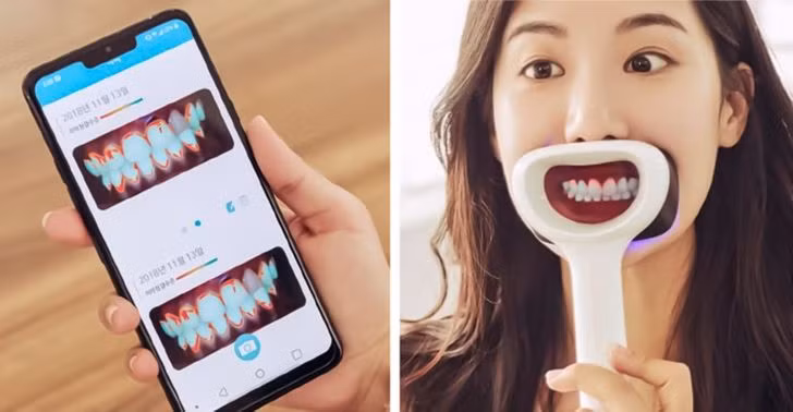 Miếng dán phân chim này giúp chống trộm xe đạp.