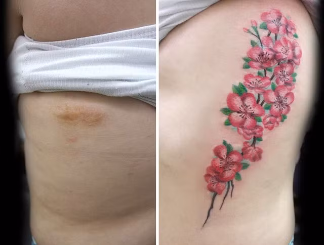 Những hình xăm biết kể nỗi đau bạo hành