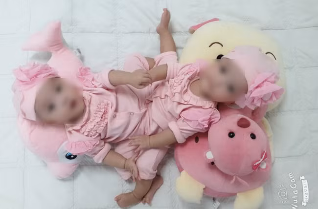 Tách rời thành công "song Nhi": Cột mốc lịch sử sau 32 năm mổ tách cặp song sinh Việt - Đức ảnh 2