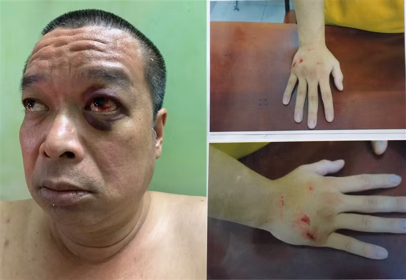 Liên quan quyết định khởi tố bị can của Công an Q.3, TPHCM: Có hay không việc “phù phép” hồ sơ vụ án? ảnh 2