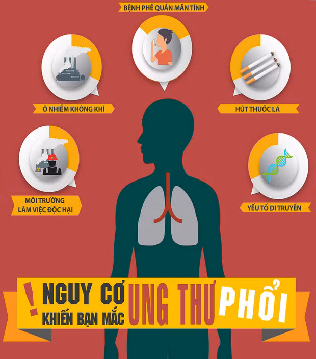 Không hút thuốc vì sao nhiều người vẫn mắc ung thư phổi? ảnh 1