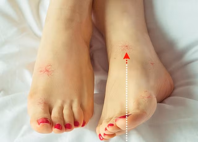 8 dấu hiệu ở chân cảnh báo bạn có thể mắc bệnh nguy hiểm ảnh 3