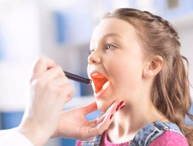 Cách xử lý hiệu quả ngay khi bị hóc xương cá ảnh 2
