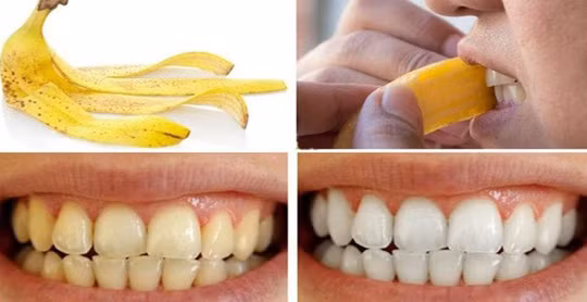 Bí quyết giúp răng trắng tinh từ nguyên liệu có sẵn trong bếp ảnh 2