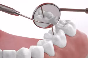 Tomikawa bị rối loạn phát triển và đã đến phòng khám để nhổ hai chiếc răng khôn. Ảnh minh hoạ.