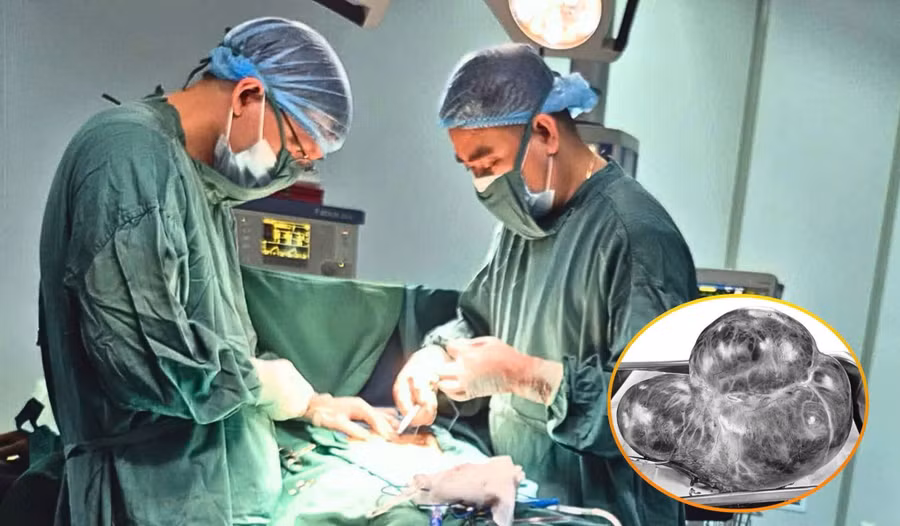 Các bác sĩ thực hiện phẫu thuật, loại bỏ khối u lớn.