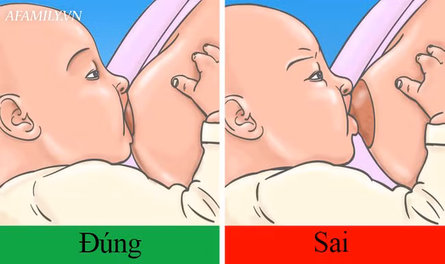 Chuyên gia tư vấn 5 việc mẹ bầu nên biết trước khi chuyển dạ ảnh 1