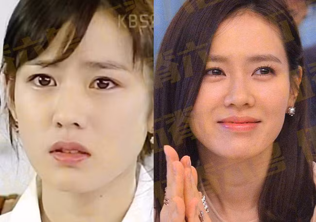 Cũng giống như Jeon Ji Hyun, Son Ye Jin là sao nữ hiếm hoi đạt được nhiều thành công vang dội bên cả điện ảnh lẫn truyền hình. Kể từ khi vào nghề, sự nghiệp của Son Ye Jin vẫn luôn thuận lợi, cô cũng tham gia nhiều bộ phim đình đám với diễn xuất ấn tượng. Ở tuổi 38, Son Ye Jin có sự nghiệp thành công nhưng cô vẫn chưa chịu kết hôn, hiện tại nữ diễn viên đang vướng tin đồn hẹn hò với Hyun Bin dù đã từng lên tiếng phủ nhận khá nhiều lần.