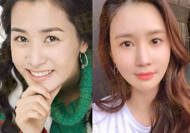 Với bộ phim My girl, Lee Da Hae trở thành nữ diễn viên hàng đầu của Hàn Quốc. Dù xinh đẹp nhưng Lee Da Hae vẫn luôn cố gắng khiến bản thân phải thật hoàn hảo bằng những cuộc phẫu thuật thẩm mỹ, làm cho gương mặt trở nên đơ cứng. Những năm qua Lee Da Hae không còn hoạt động nhiều trong showbiz, cô chuyển hướng sang làm blogger.