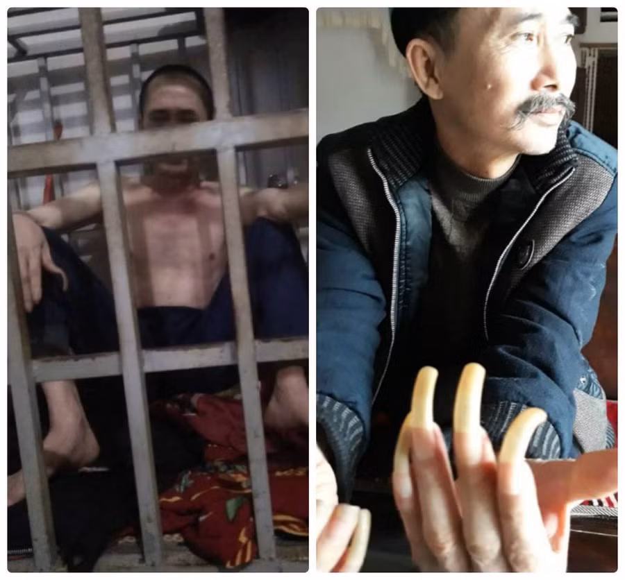 Ông Lê Văn Năm sống trong lồng sắt nhiều năm. Ảnh: Báo Bảo vệ Pháp luật