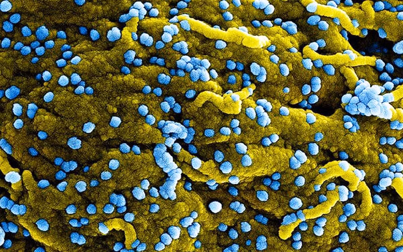Virus Marburg (màu xanh lam), vừa sinh sôi và gắn trên bề mặt của các tế bào bị nhiễm bệnh (màu vàng). (Ảnh: VTV).