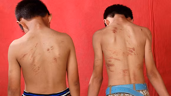 Bắt 7 đối tượng “cướp máu” trẻ em